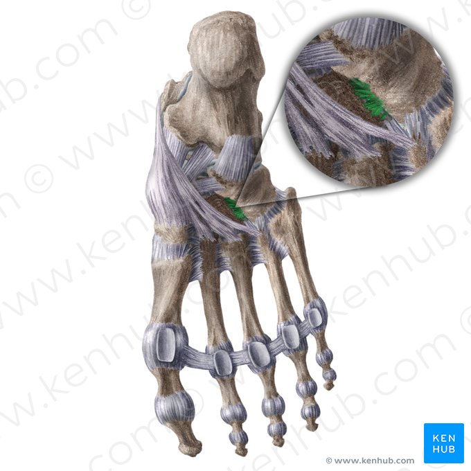 Ligamento cuneocubóideo plantar (Ligamentum cuneocuboideum plantare); Imagem: Liene Znotina