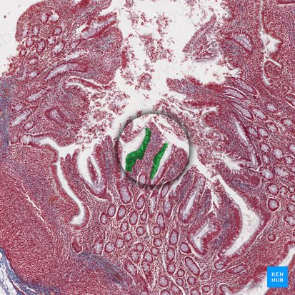 Epithelium simplex columnare microvillosum (Einschichtig hochprismatisches Epithel (mit Bürstensaum)); Bild: 