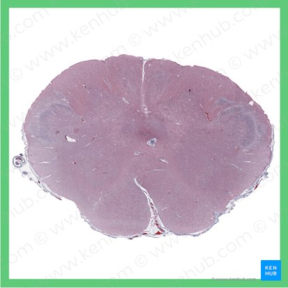 Medulla oblongata; Image: 