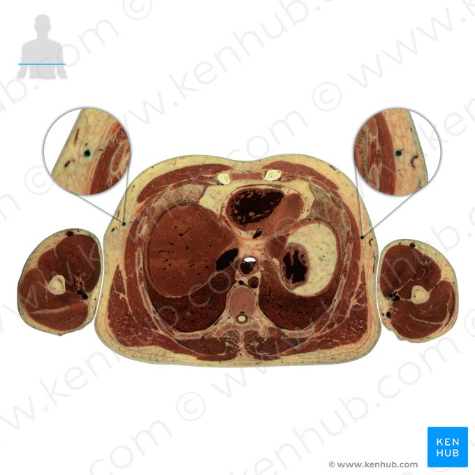 Thoracoepigastric vein (Vena thoracoepigastrica); Image: National Library of Medicine