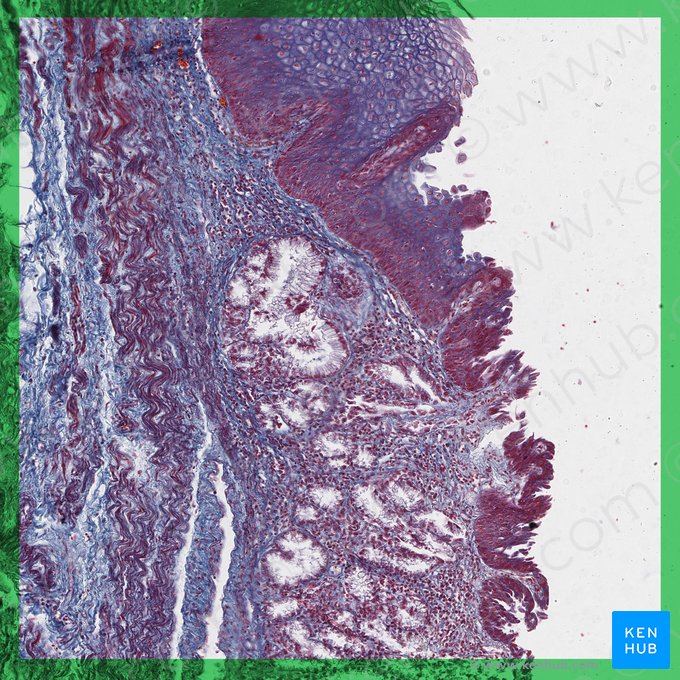 Esophagogastric junction (Junctio oesophagogastrica); Image: 