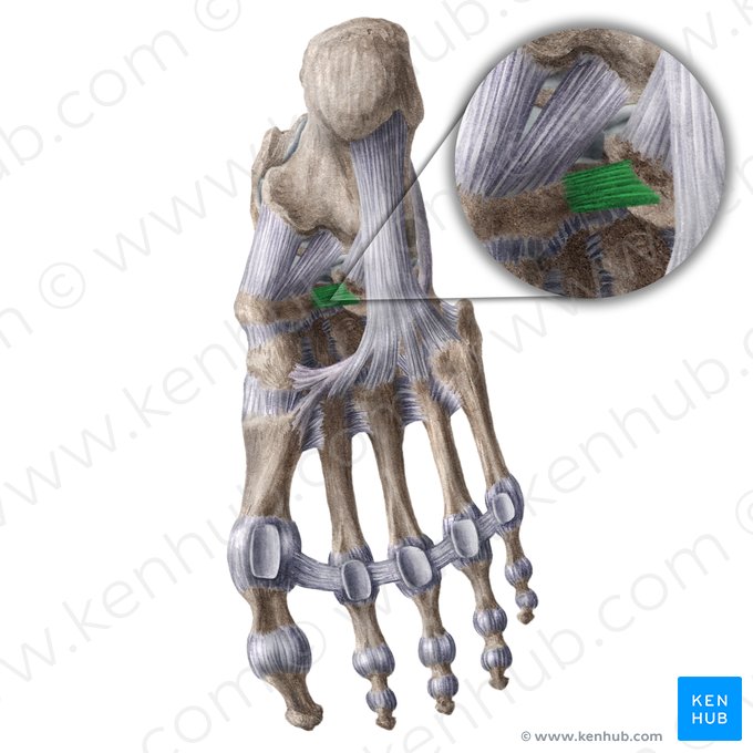 Ligamento cuboideonavicular plantar (Ligamentum cuboideonaviculare plantare); Imagem: Liene Znotina