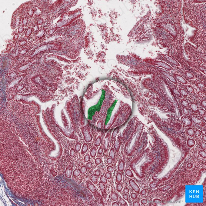 Epitélio colunar simples (com borda em escova) (Epithelium simplex columnare microvillosum); Imagem: 