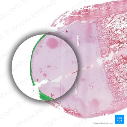 Tangentialzone; Bild: 