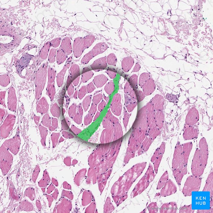 Périmysium (Perimysium); Image : 