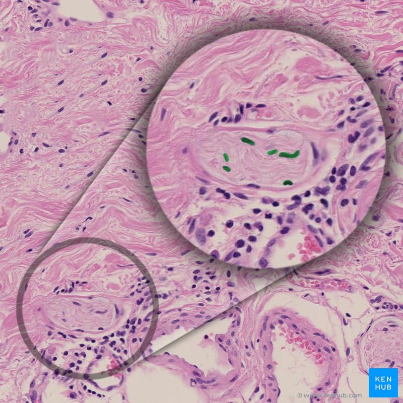 Schwann cell - histological slide