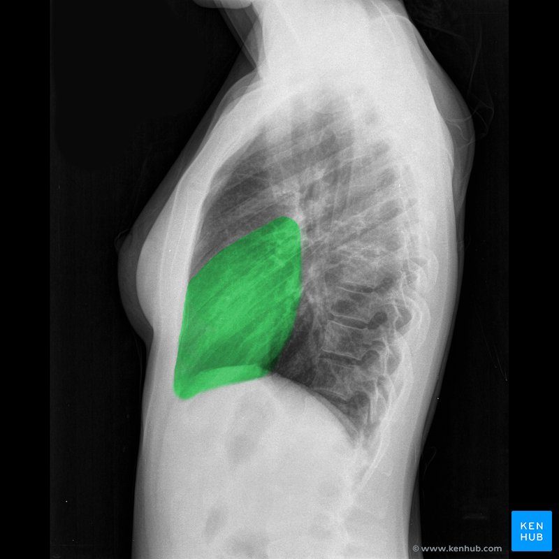 Lateral chest X-ray