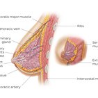 Clinical case: Breast cancer development after prophylactic subcutaneous mastectomy