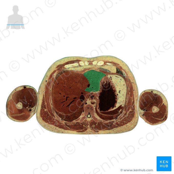 Left lobe of liver (Lobus sinister hepatis); Image: National Library of Medicine