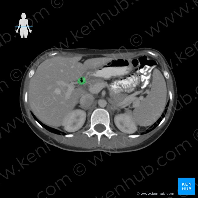 Duodenum; Image: 