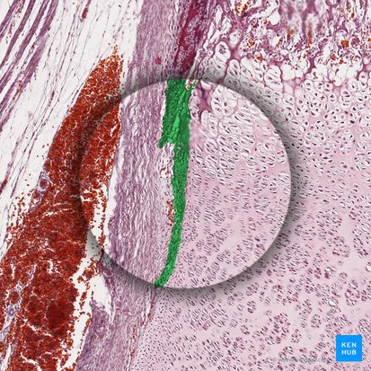 Fibrocartílago; Imagen: 