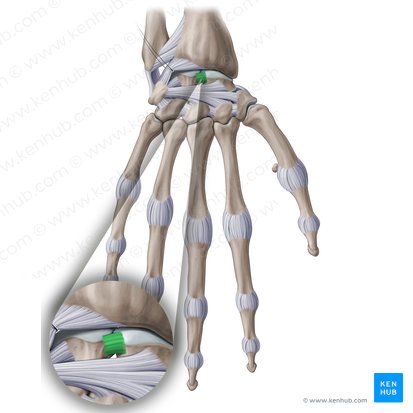 Scapholunate interosseous ligament (Ligamentum scapholunatum interosseum); Image: Paul Kim