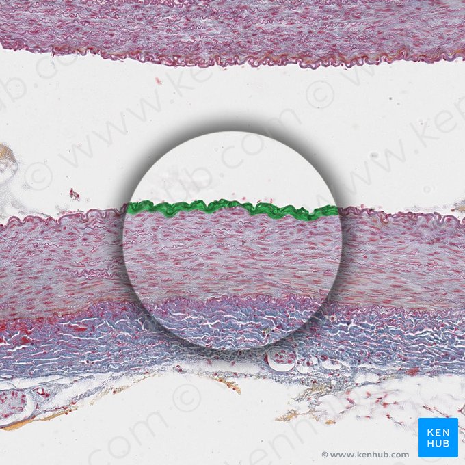 Tunica intima of artery (Tunica intima arteriae); Image: 