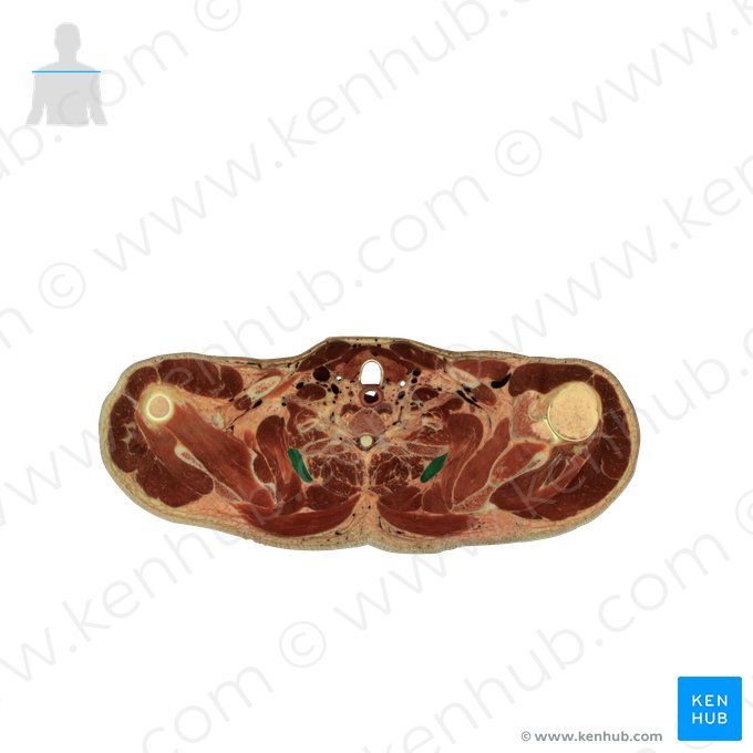 Levator scapulae muscle (Musculus levator scapulae); Image: National Library of Medicine