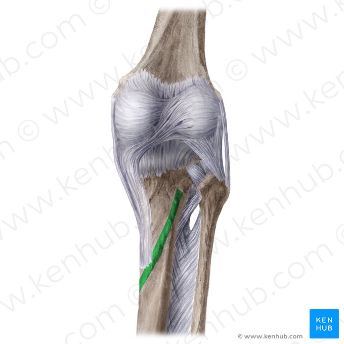 Línea del sóleo de la tibia (Linea musculi solei tibiae); Imagen: Liene Znotina