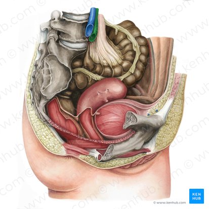 Arteria iliaca communis dextra (Rechte gemeinsame Beckenarterie); Bild: Irina Münstermann