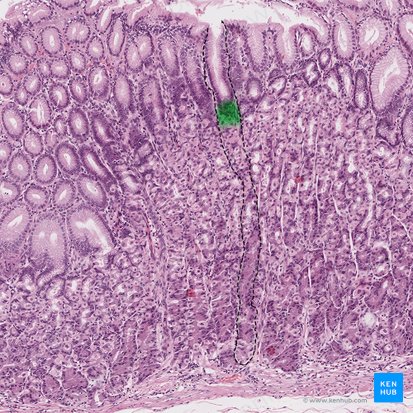 Itsmo de las glándulas gástricas (Isthmus glandulae gastricae); Imagen: 