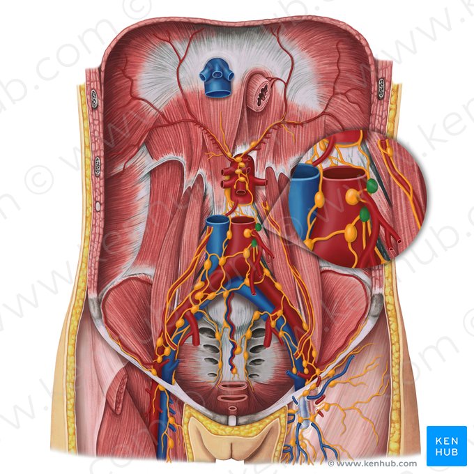 Nodi lymphoidei aortici laterales (Seitliche Aortenlymphknoten); Bild: Irina Münstermann