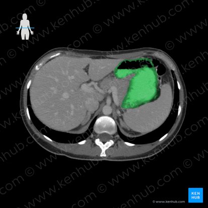 Estomac (Gaster); Image : 