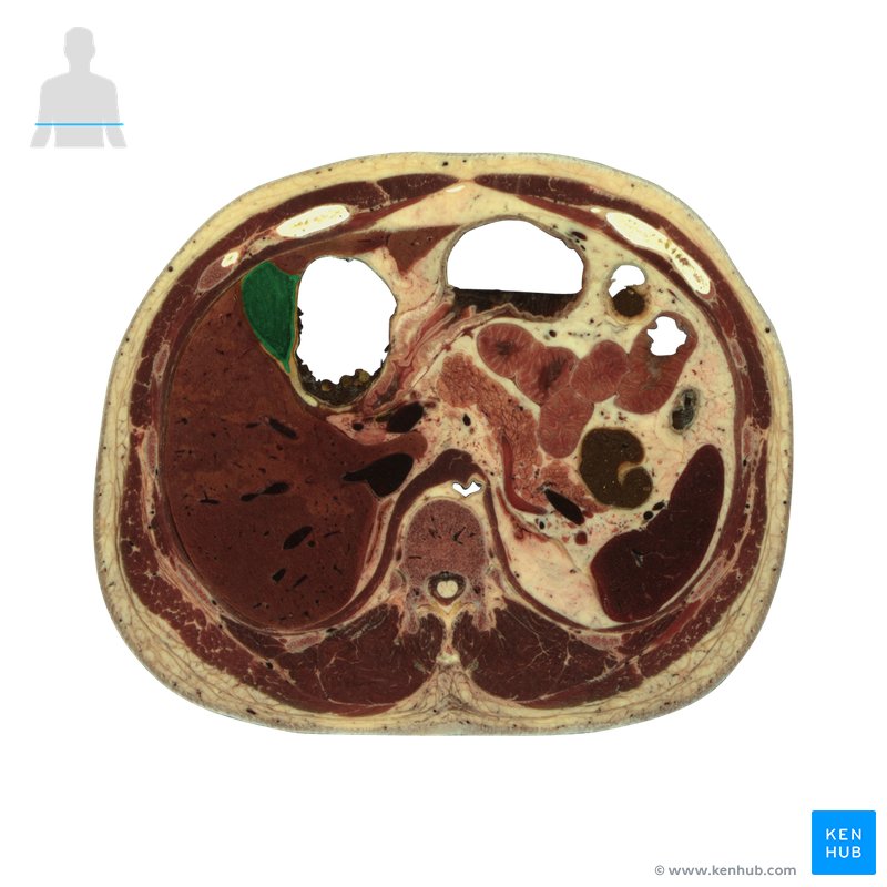 Gallbladder - axial view