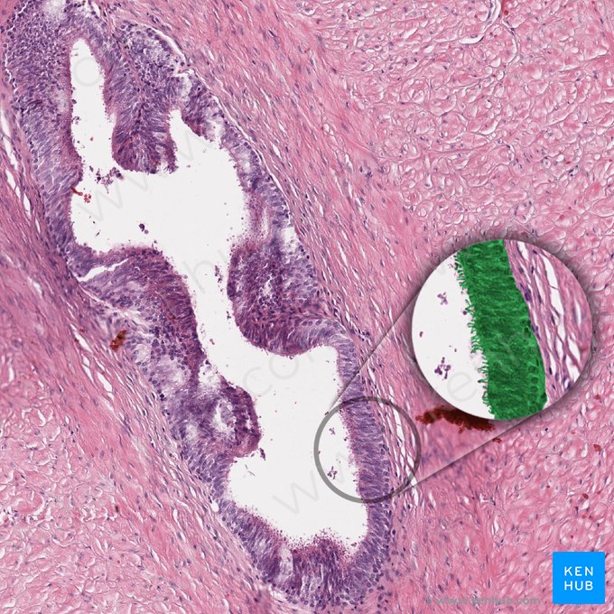 Epitelio cilíndrico pseudoestratificado con estereocilios (Epithelium pseudostratificatum columnare stereociliatum); Imagen: 