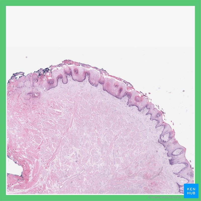 Tongue - histological slide