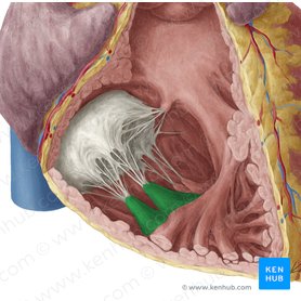 Musculus papillaris anterior ventriculi dextri (Vorderer Papillarmuskel der rechten Herzkammer); Bild: Yousun Koh