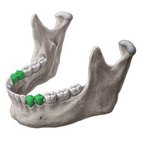 Premolar teeth