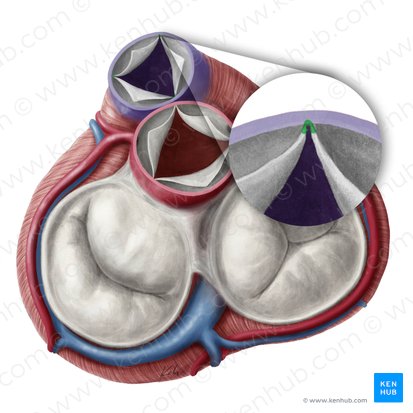 Commissures of semilunar leaflets of pulmonary valve (Commissurae valvularum semilunarium valvae trunci pulmonalis); Image: Yousun Koh
