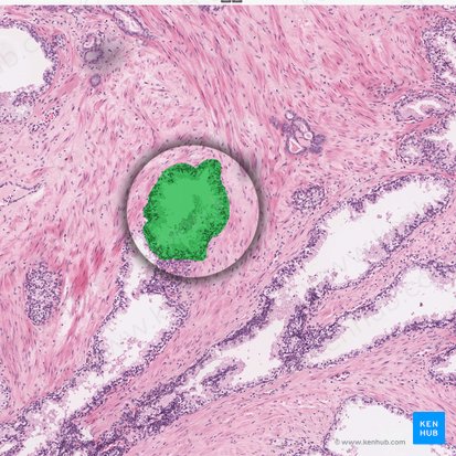 Prostatic acinus; Image: 