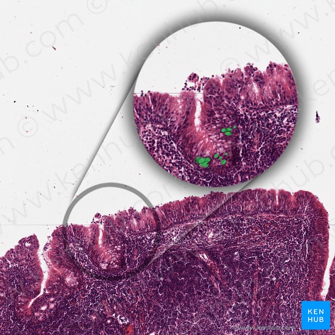 Célula caliciforme (Exocrinocytus caliciformis); Imagem: 