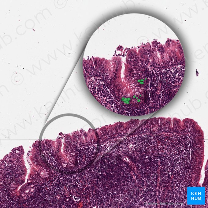 Goblet cell (Exocrinocytus caliciformis); Image: 