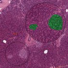 Páncreas (histología)