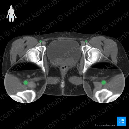 Artéria femoral (Arteria femoralis); Imagem: 