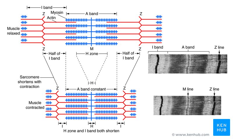 Skeletal muscle sarcomere