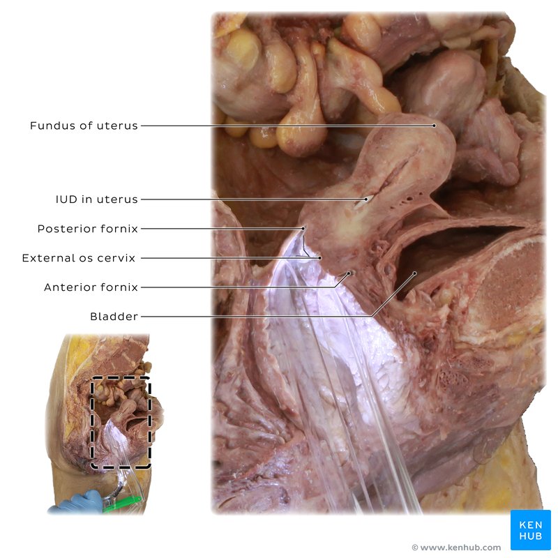 Uterus inside a cadaver