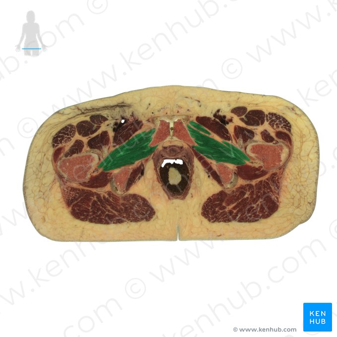 Músculo obturador externo (Musculus obturatorius externus); Imagem: National Library of Medicine