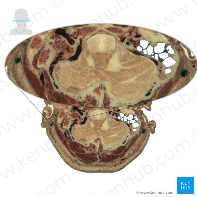 Posterior auricular vein (Vena auricularis posterior); Image: National Library of Medicine