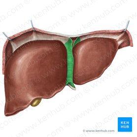 Ligamento falciforme del hígado (Ligamentum falciforme hepatis); Imagen: Irina Münstermann