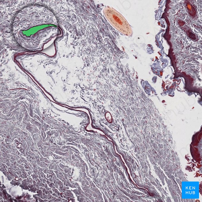 Fornix of lacrimal sac; Image: 