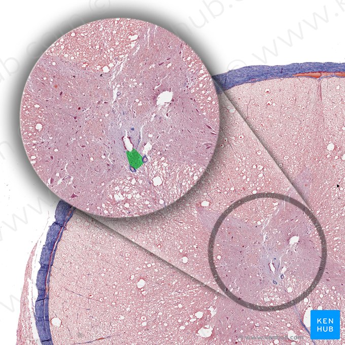 Commissura grisea anterior (Vordere graue Kommissur); Bild: 