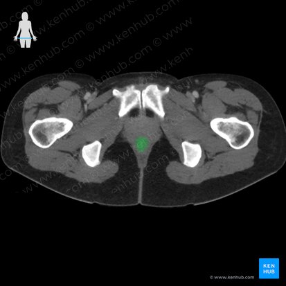 Canal anal (Canalis analis); Imagem: 