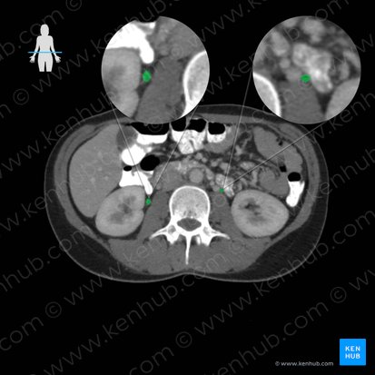 Ureter; Image: 