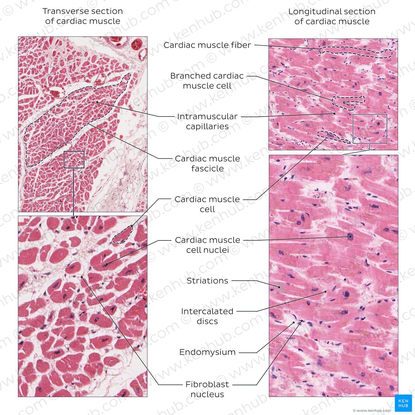 Cardiac Muscle Tissue Labeled