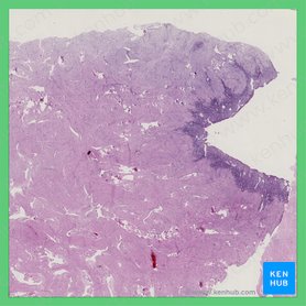 Uterus: Anatomy, blood supply, histology, functions | Kenhub