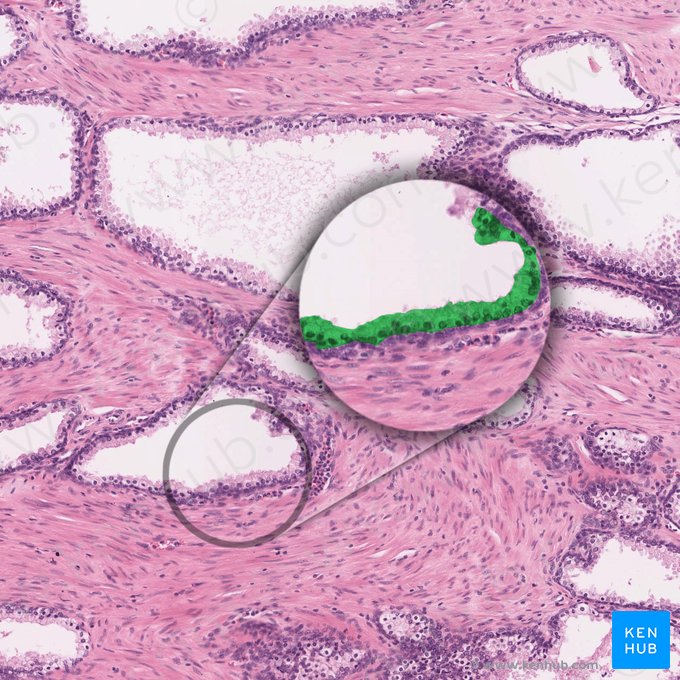 Epitélio colunar simples (Epithelium simplex columnare); Imagem: 