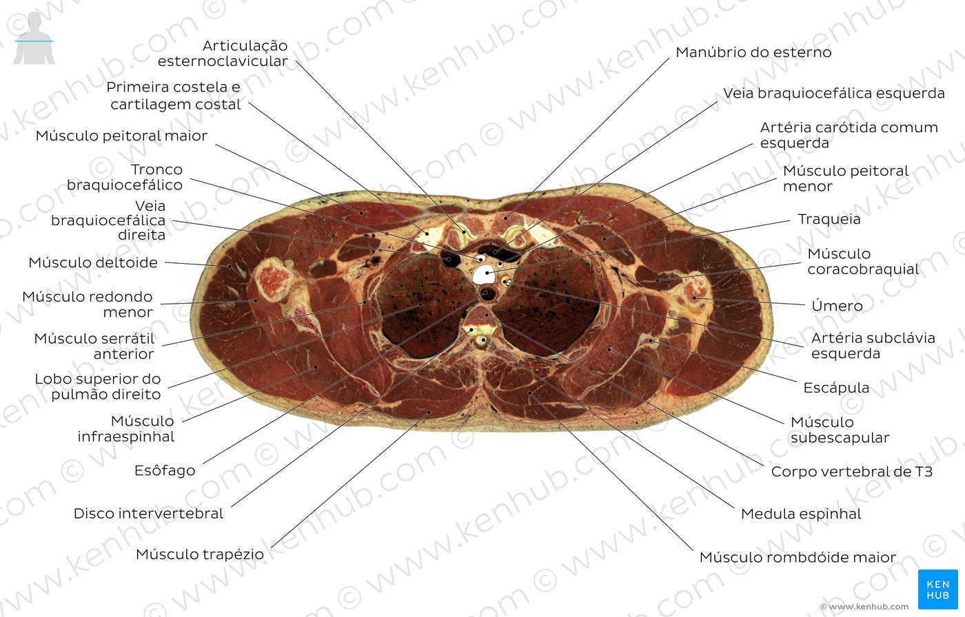 Corte transversal através de T3 - Diagrama