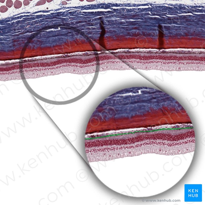 Epitelio cúbico pigmentario de la retina (Epithelium simplex cuboideum pigmentosum); Imagen: 