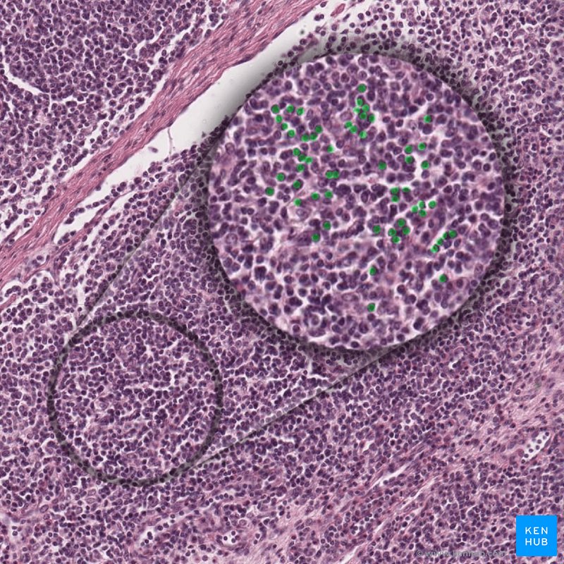 Lymphocytes - histological slide