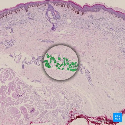 Sweat gland (Glandula sudorifera); Image: 